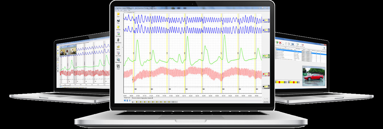 CIT psychophysiological monitoring software displaying physiological waveforms across multiple screens